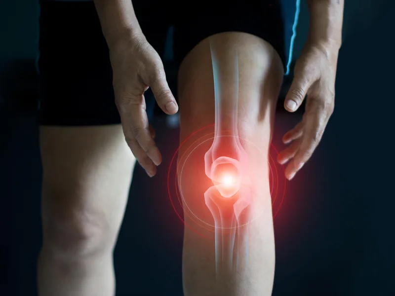 How Plymouth Spine and Health Center treats arthritis in Plymouth